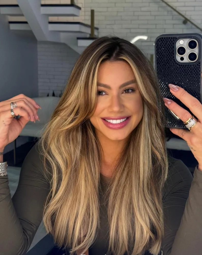 Janaina Santucci renova seu sorriso com lentes de cerâmica mais naturais