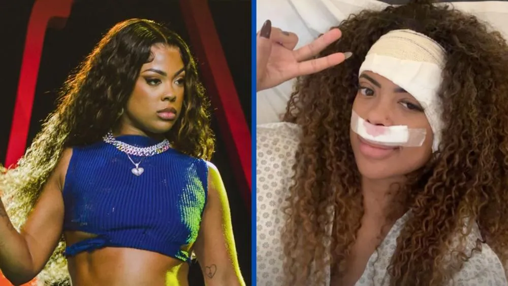 Cantora Marvvila passa por cirurgias para retirar tumor benigno e tem quadro de saúde atualizado
