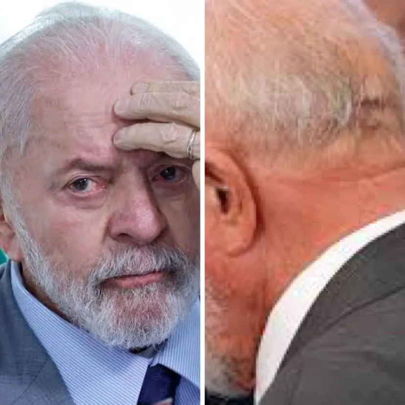 Após passar por cirurgia de emergência na cabeça, Lula se recupera bem: “acordado e conversando”