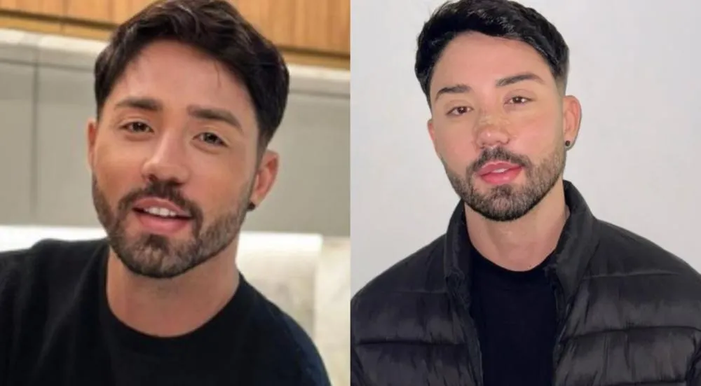 Rico Melquiades choca ao revelar plano de “trocar os pés” após desejo de reduzir altura: “Vi em um vídeo”