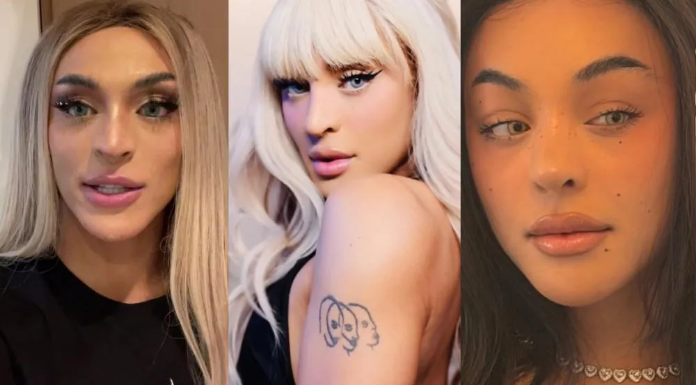 Pabllo Vittar surge com novo rosto após 3ª rinoplastia e expõe drama pessoal durante recuperação
