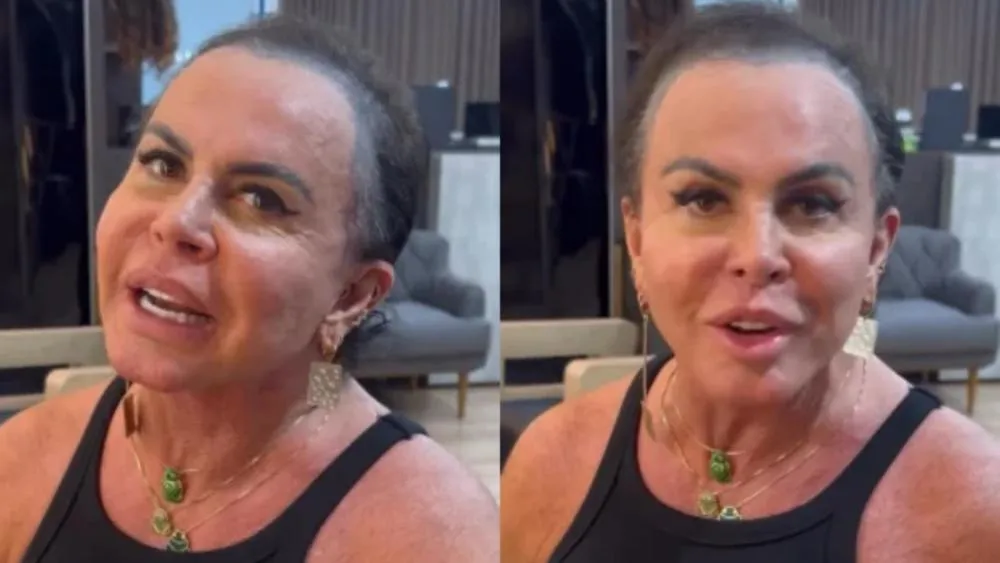 Gretchen revela piora na alopecia após procedimento estético: “Perdi todo o cabelo”