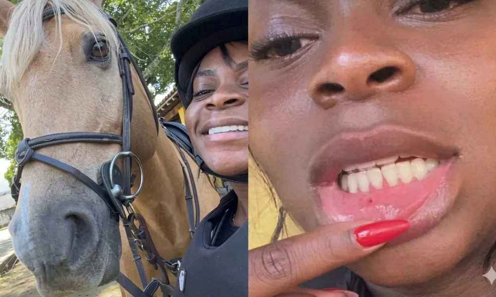 “Arrebentada”: Jojo Todynho mostra ferimentos após acidente com cavalo