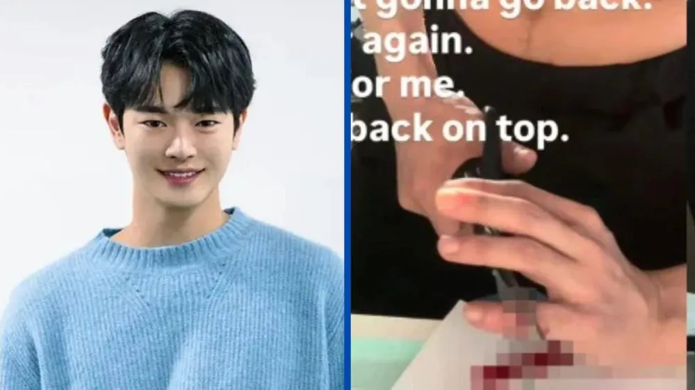Astro sul-coreano assusta fãs com vídeo cortando o próprio dedo: “Passei a odiá-lo e cortei”