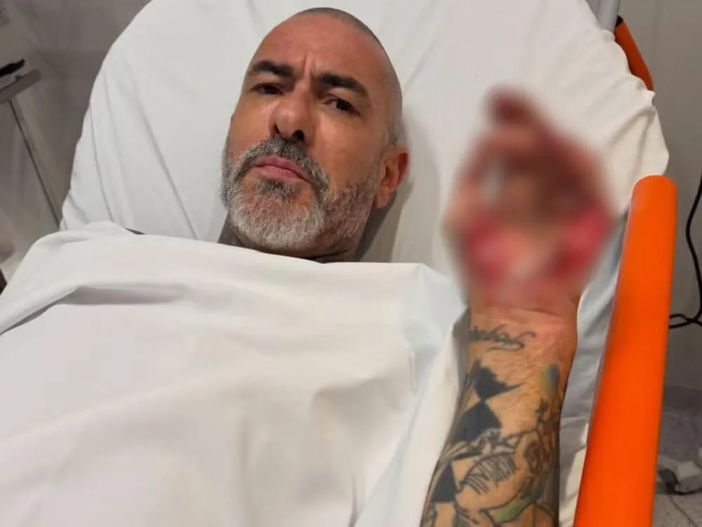 Henrique Fogaça expõe feridas de acidente de moto e diz ter sido roubado no hospital