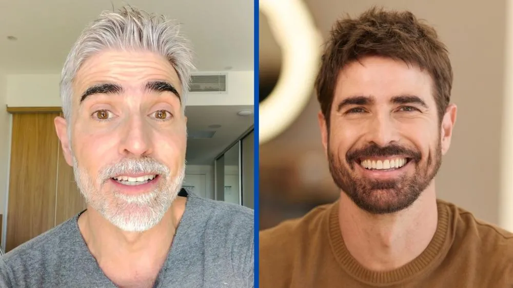 Antes e depois: Reynaldo Gianecchini passa por transformação e abandona os cabelos grisalhos
