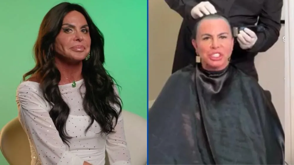 Gretchen raspa o cabelo ao vivo e desabafa sobre luta contra doença que mudou sua aparência