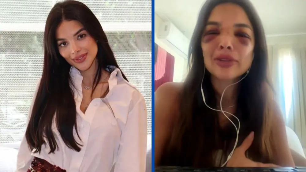 Dentista agredida por empresário da Faria Lima revela que ex-marido usava golpes para não deixar marcas