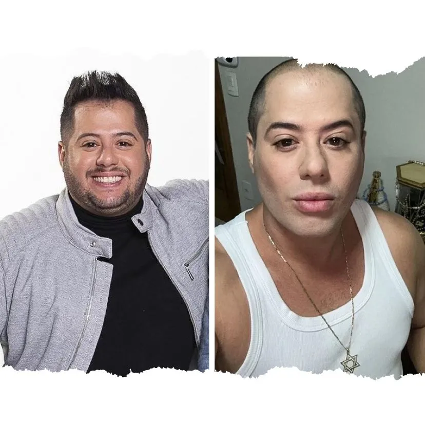  Hugo, da dupla com Tiago, surge 66 quilos mais magro, com harmonização facial e surpreende a web