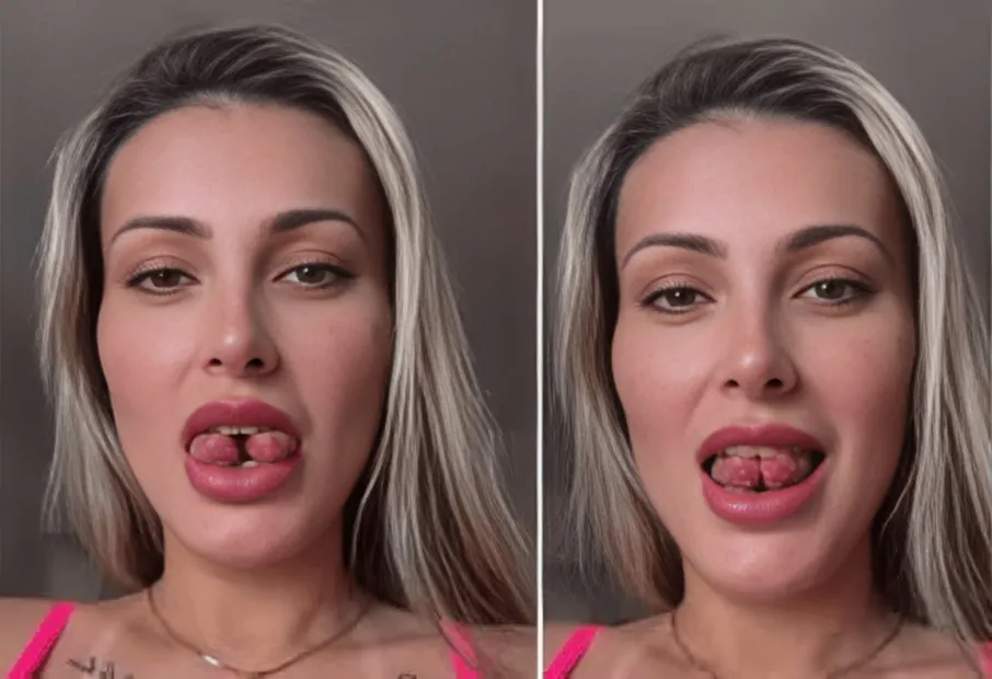 Andressa Urach decide desfazer bifurcação da língua após acidente em gravação: “Hoje me arrependo”