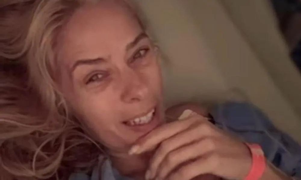 Após febre alta durante viagem, Adriane Galisteu descobre cálculo renal e passa por cirurgia de emergência; saiba detalhes