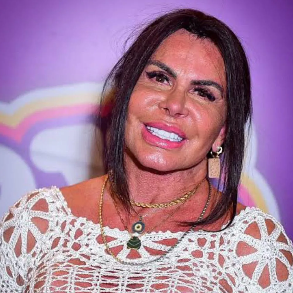 Gretchen passa por cirurgia para retirar substância perigosa dos lábios