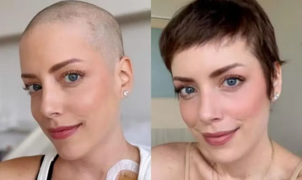 No hospital, Fabiana Justus compara Carnavais de 2024 e 2025 em trend: “Surreal pensar em tudo que eu passei”