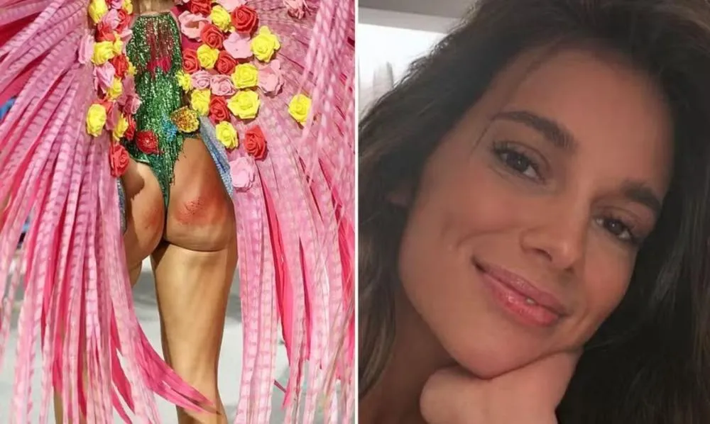 “Todo ferido”, atualiza ex-BBB, Alane Dias, sobre machucados no bumbum em desfile da Grande Rio