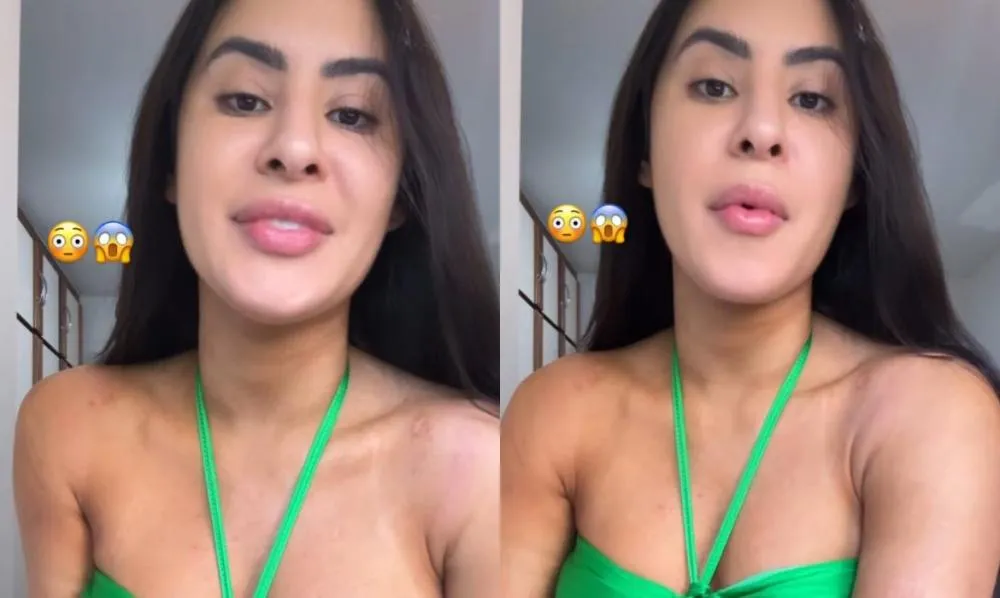 “São marcas da arte”, desabafa Isabelle Nogueira sobre ferimentos causados por fantasias no Carnaval 2025