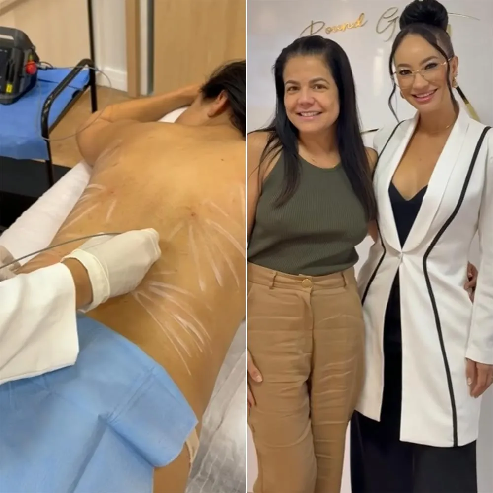 Atriz Nivea Stelmann recorre à procedimento para “Ficar magra sem lipo”