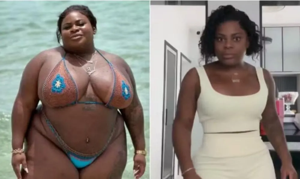 “Estava explodindo”, reflete Jojo Todynho após perder 80kg com bariátrica