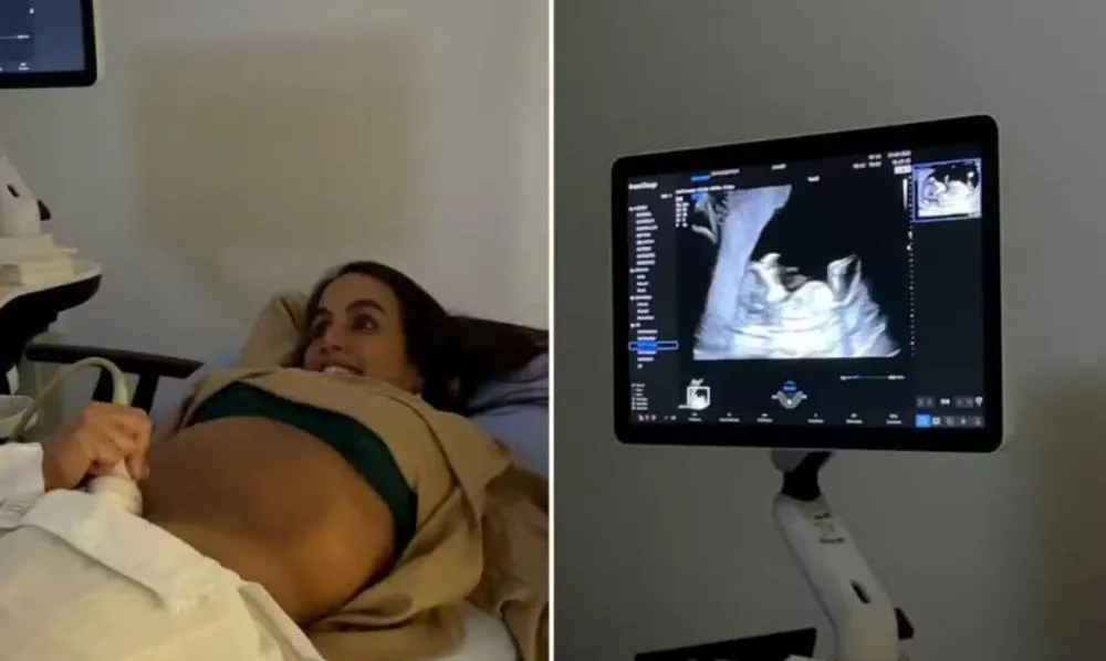Em registros do mês de março, Carol Peixinho compartilha 1° ultrassom da gravidez ao lado de Thiaguinho