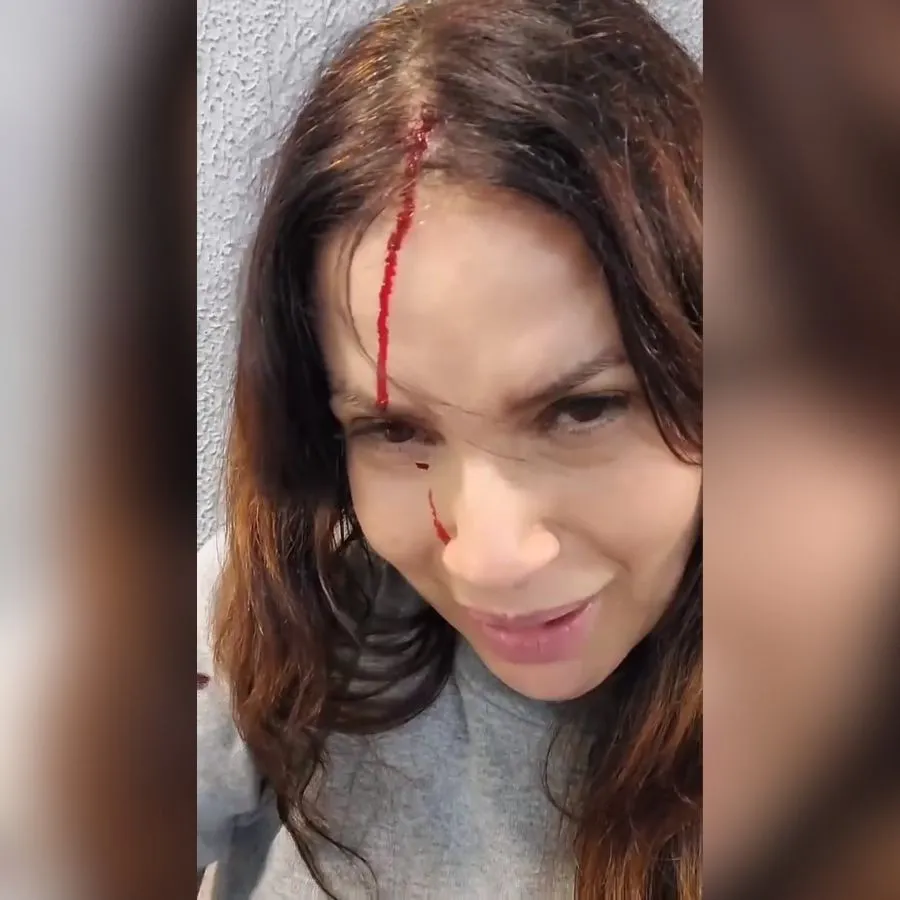 Isadora Ribeiro sofre acidente e grava vídeo de alerta aos seus seguidores