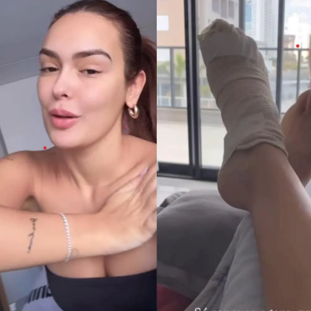 Ex-BBB Larissa Santos sofre acidente e leva 14 pontos após vidro do box estourar