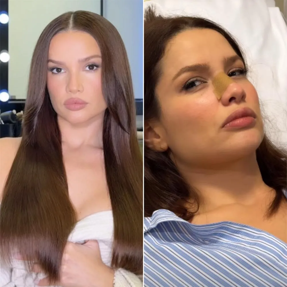 Ex-BBB Juliette sofre acidente doméstico e mostra curativo no nariz