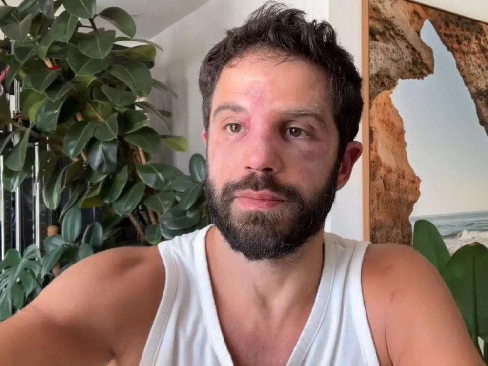 Duda Nagle é barrado em academia após luta com Popó: rosto inchado impede reconhecimento facial
