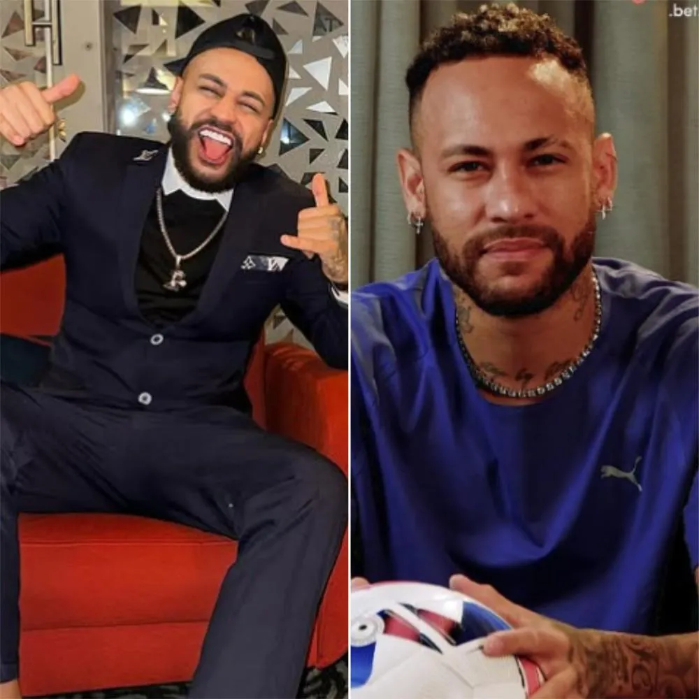 Sósia de Neymar investe alto em rinoplastia para ficar mais parecido com o ídolo; veja o resultado