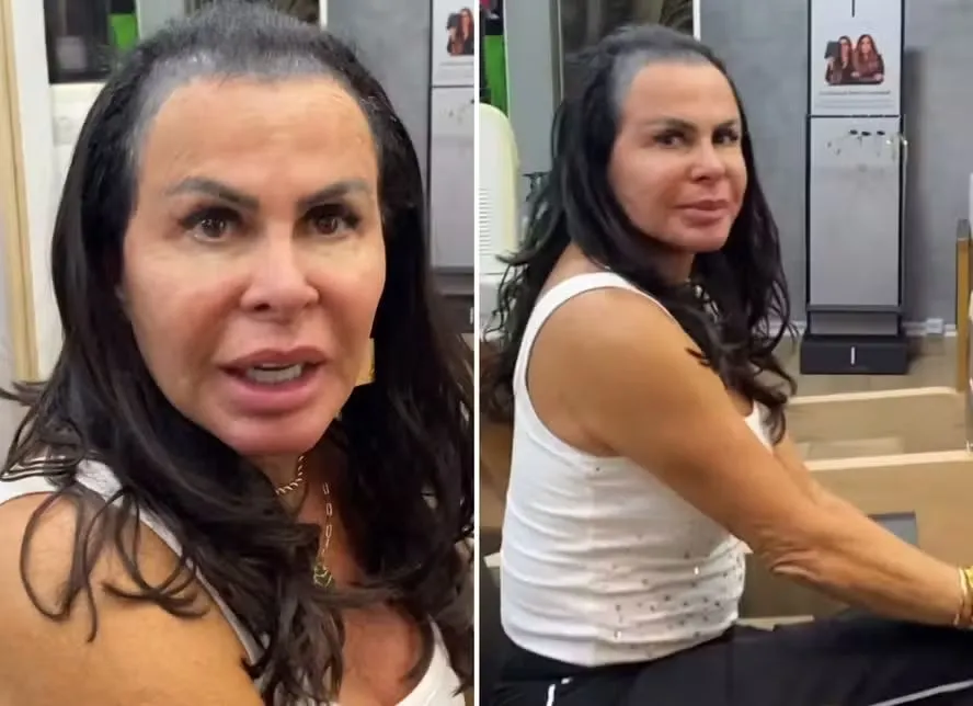 Gretchen surge com cabelos falhados e causa curiosidade nas redes. Entenda os motivos.