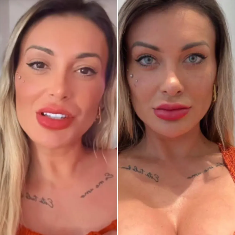 Andressa Urach - Antes e Depois Foto (Montagem: Portal Felipeh Campos)