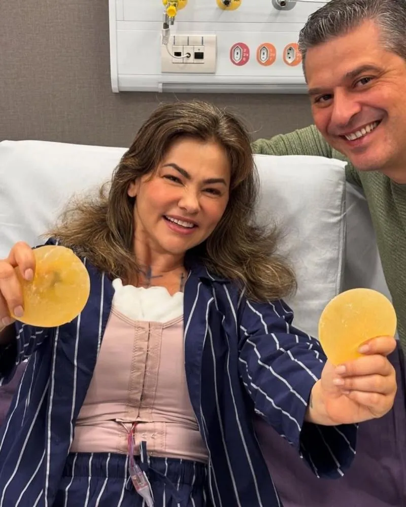 Suzana Alves, a 'Tiazinha', mostra próteses após retirar silicone: “Liberta!”