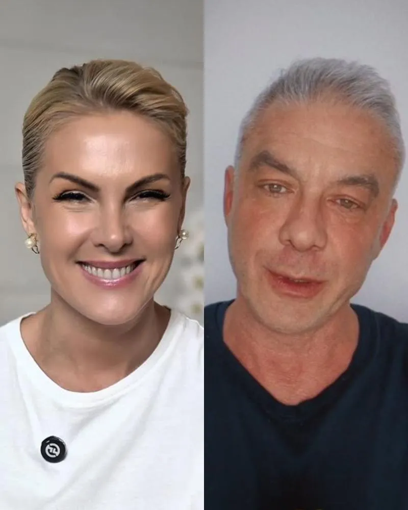Ana Hickmann celebra condenação do ex-marido por agressão: “Aliviada”