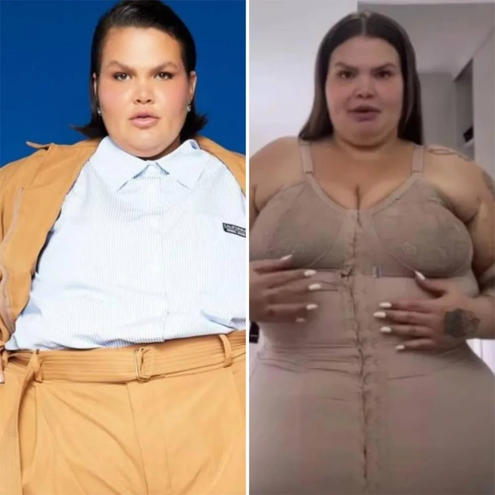 Após perder 50kg, Thais Carla aparece sem cinta e expõe corpo sem cinta