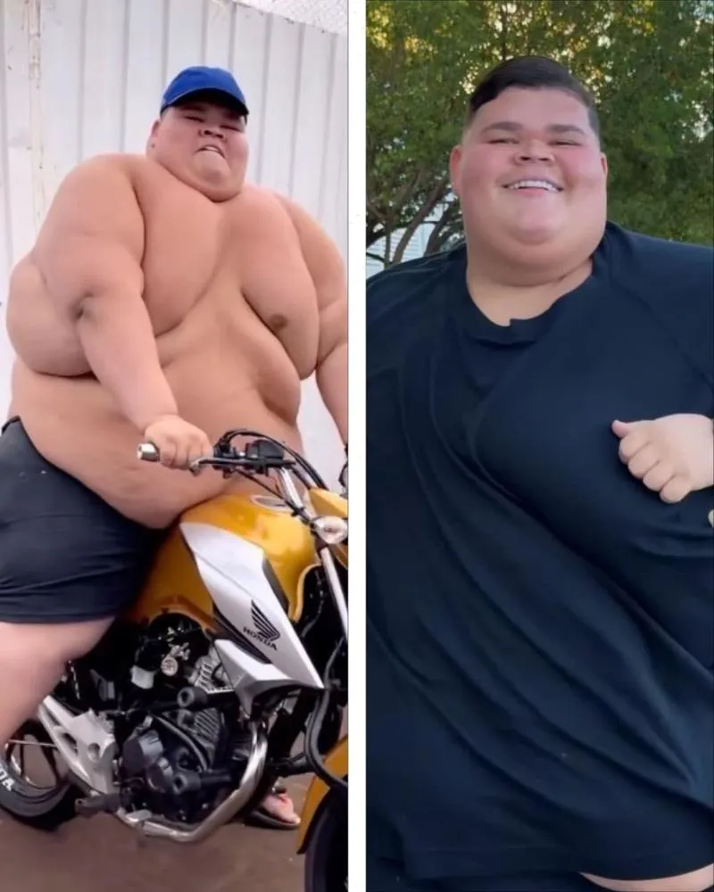 Após perder 100kg em um ano, Gordão da XJ anuncia cirurgia bariátrica