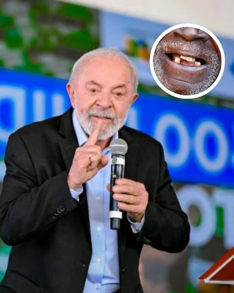 Lula critica foto usada em propaganda do governo: “Um cara sem dente e ainda negro”