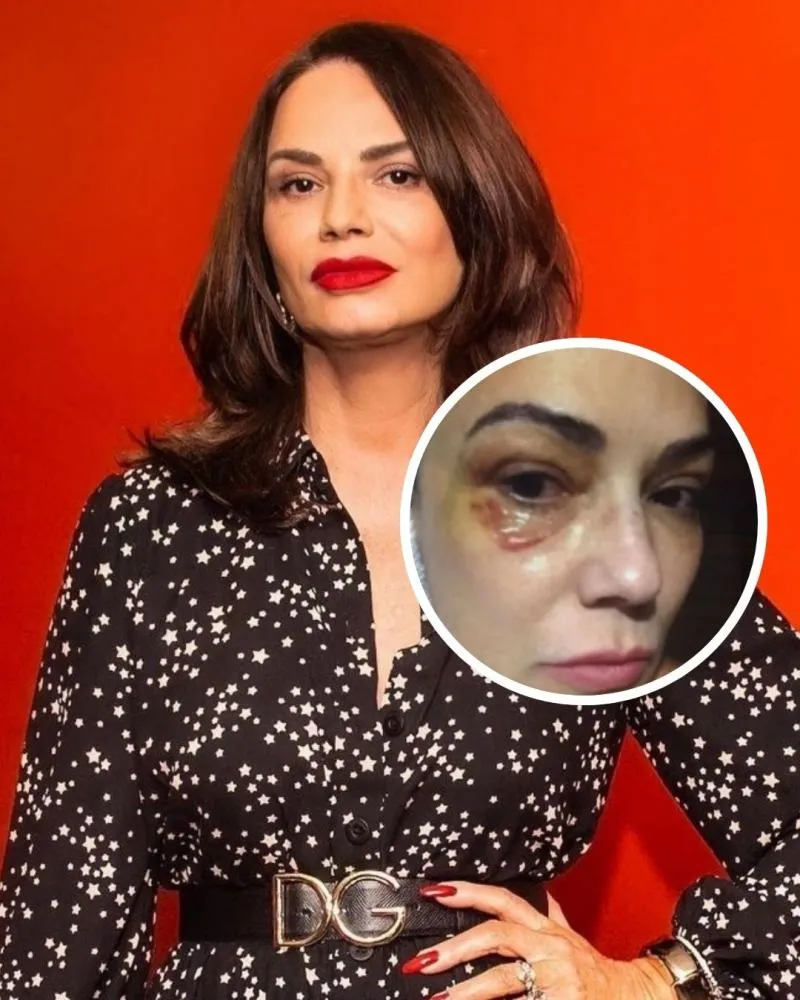 Luiza Brunet pede indenização de R$ 1 milhão a ex-marido por agressão e prejuízo financeiro