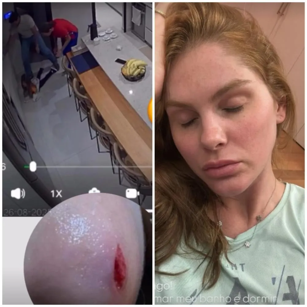 Bárbara Evans se desespera com acidente doméstico da filha: “Estou tremendo”