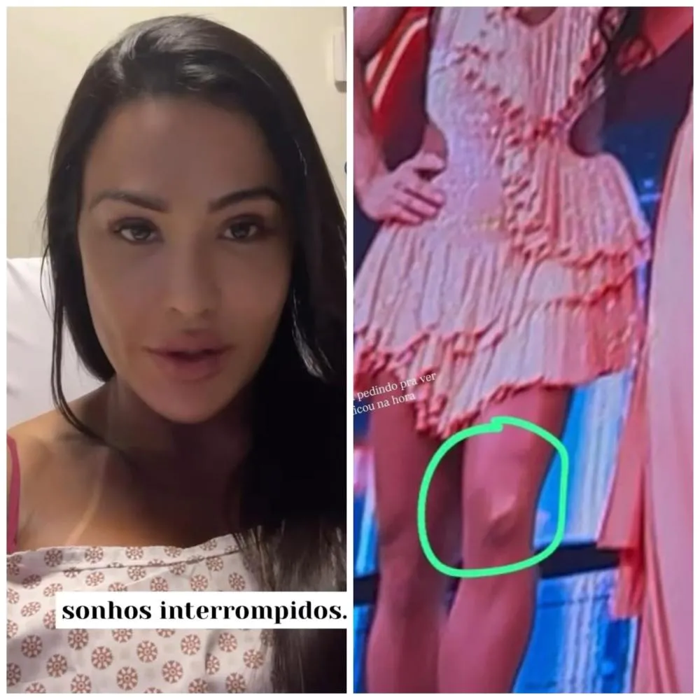 Acamada no hospital, Gracyanne Barbosa desabafa sobre lesão na Dança dos Famosos