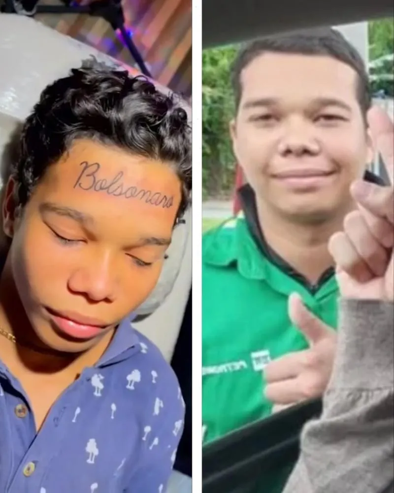 Jovem remove tatuagem de Bolsonaro da testa e revela nova visão política: “Assunto muito complicado”