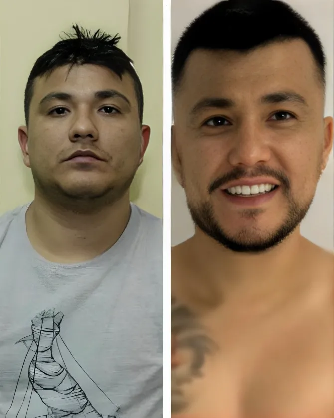 Chefe de facção criminosa fez plásticas para fugir da Polícia Federal; veja o antes e depois