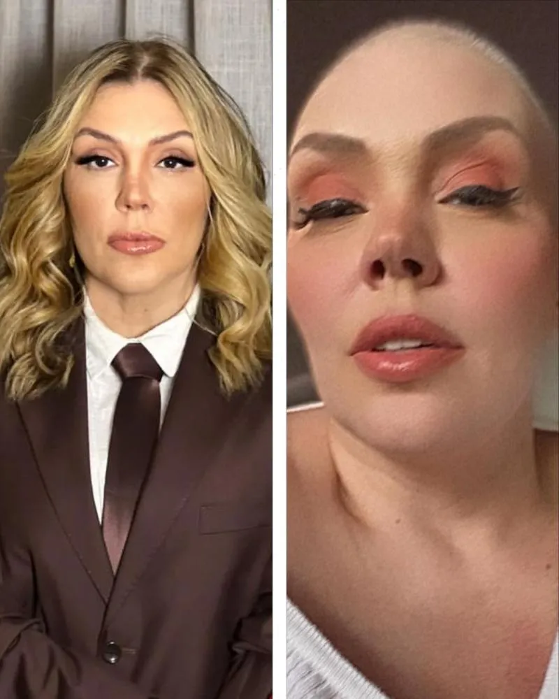 Simony posta foto e faz importante alerta sobre a prevenção do câncer de mama: “Não espere a idade certa”