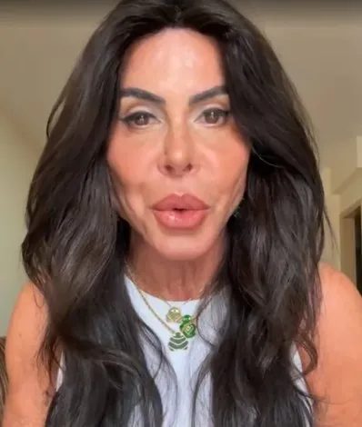 Gretchen nega cirurgias e explica “reprogramação” da harmonização facial após perder 10 kg