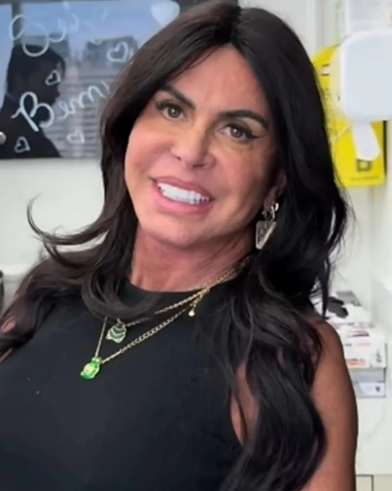 Após harmonização, Gretchen rebate críticas e dispara: “A bunda é minha e eu faço o que quiser”