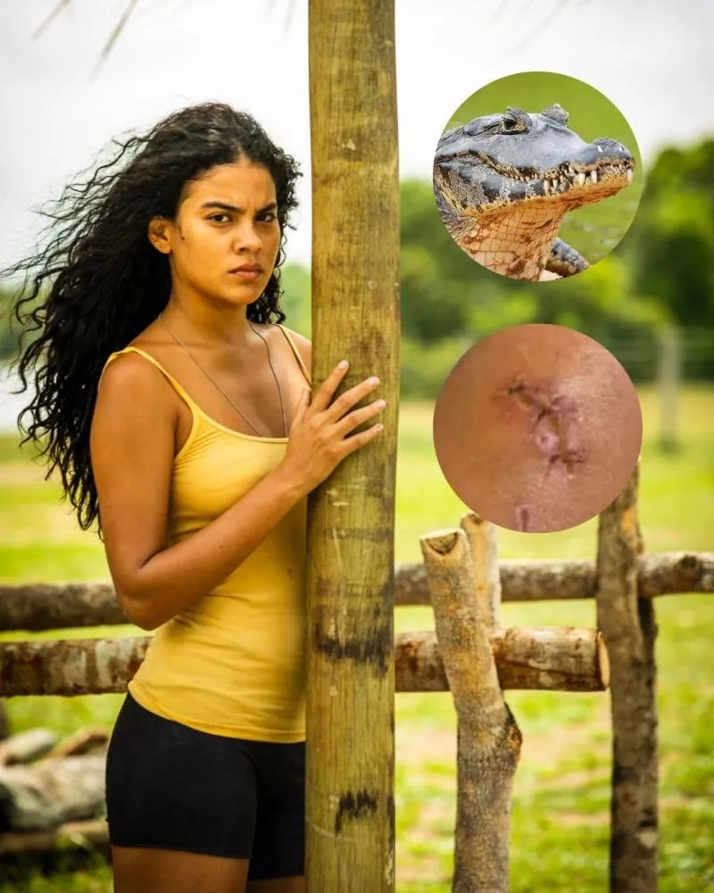 Bella Campos relembra encontro assustador com jacaré no Pantanal e mostra marca de mordida: “Abocanhou minha perna”