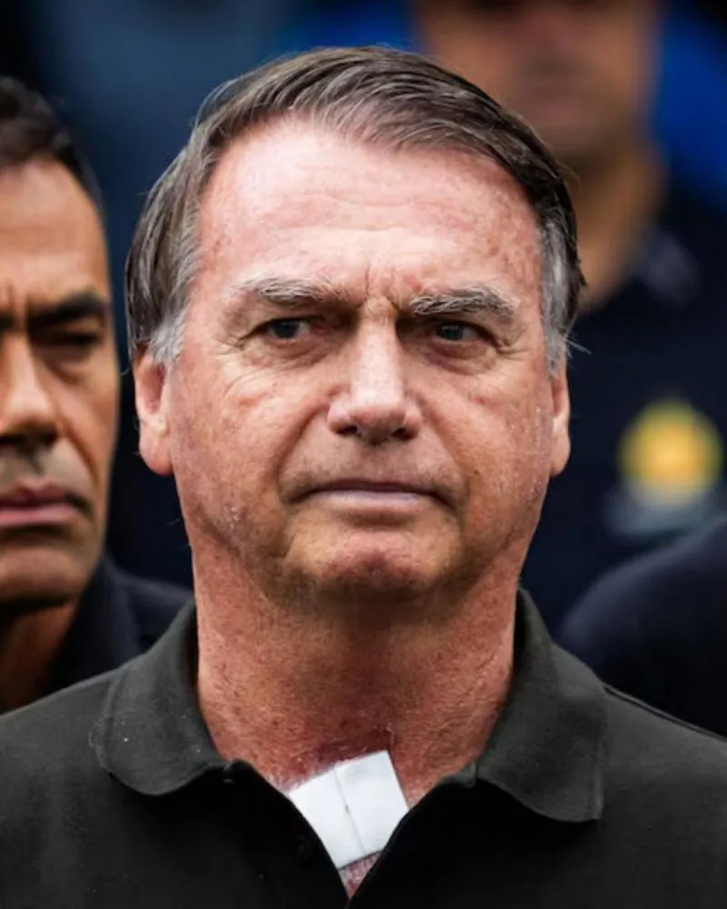 Bolsonaro passa por ultrassom e médicos indicam cirurgia