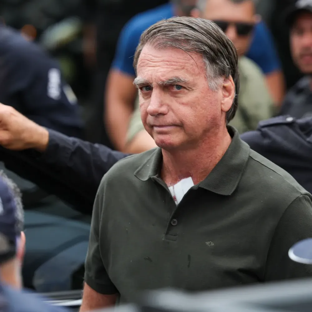 Bolsonaro passa por novo procedimento para conter crises de soluço nesta segunda