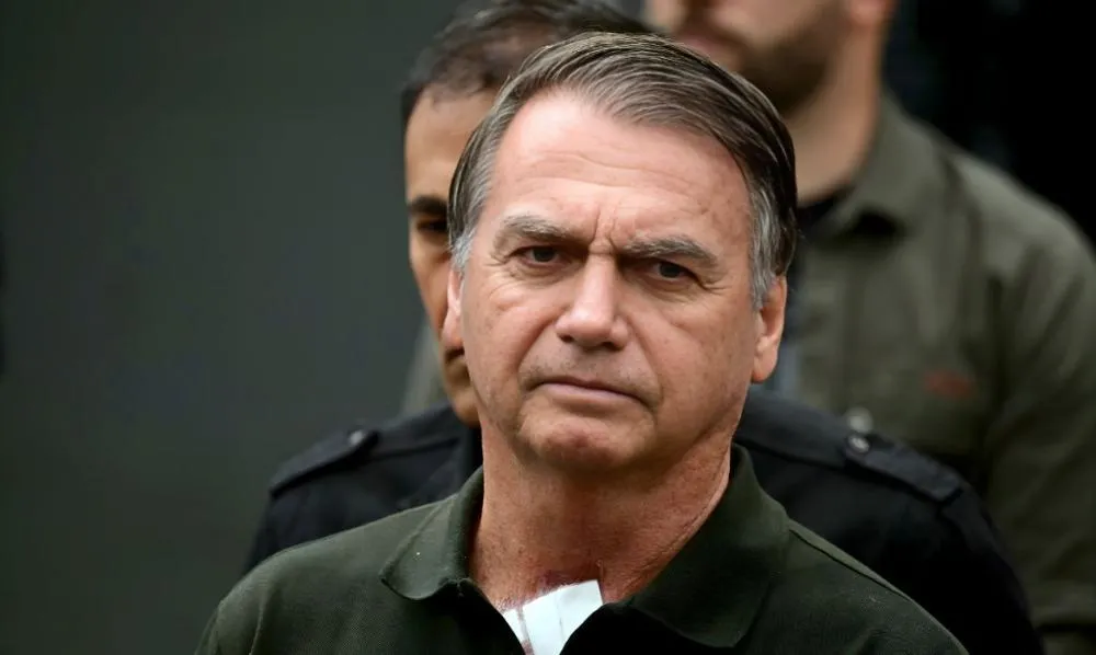 Bolsonaro realizará uma endoscopia nesta quarta após cirurgia para conter soluços
