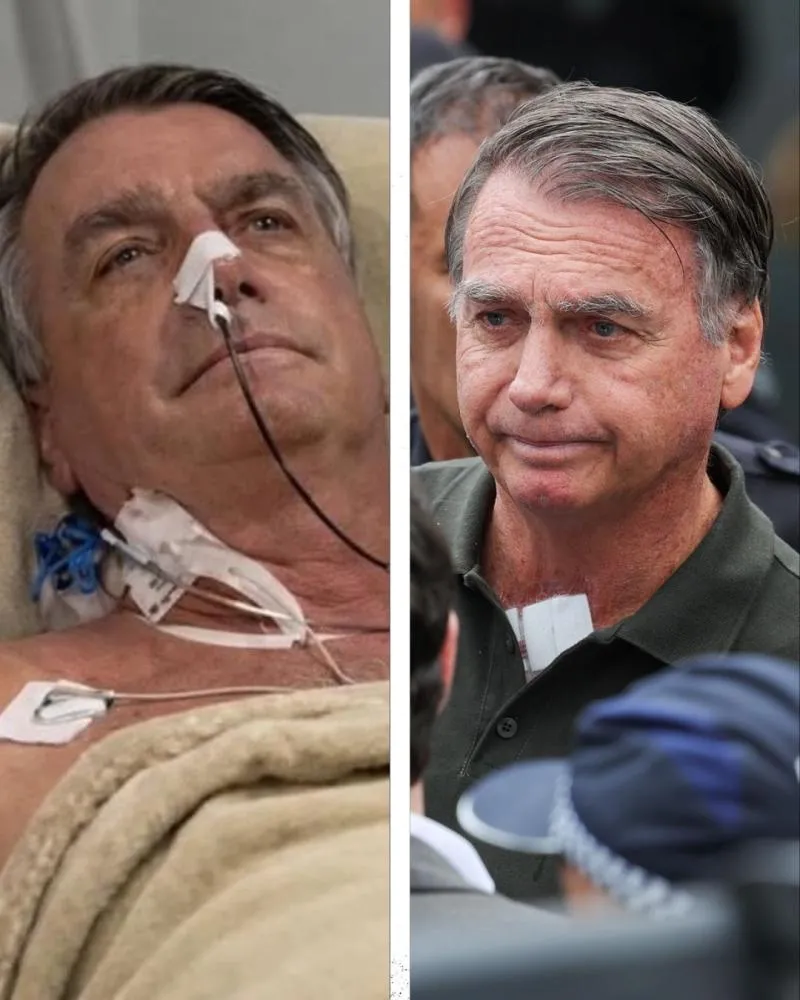 Após queda na PF, cama de Bolsonaro na Papudinha conta com grade de proteção