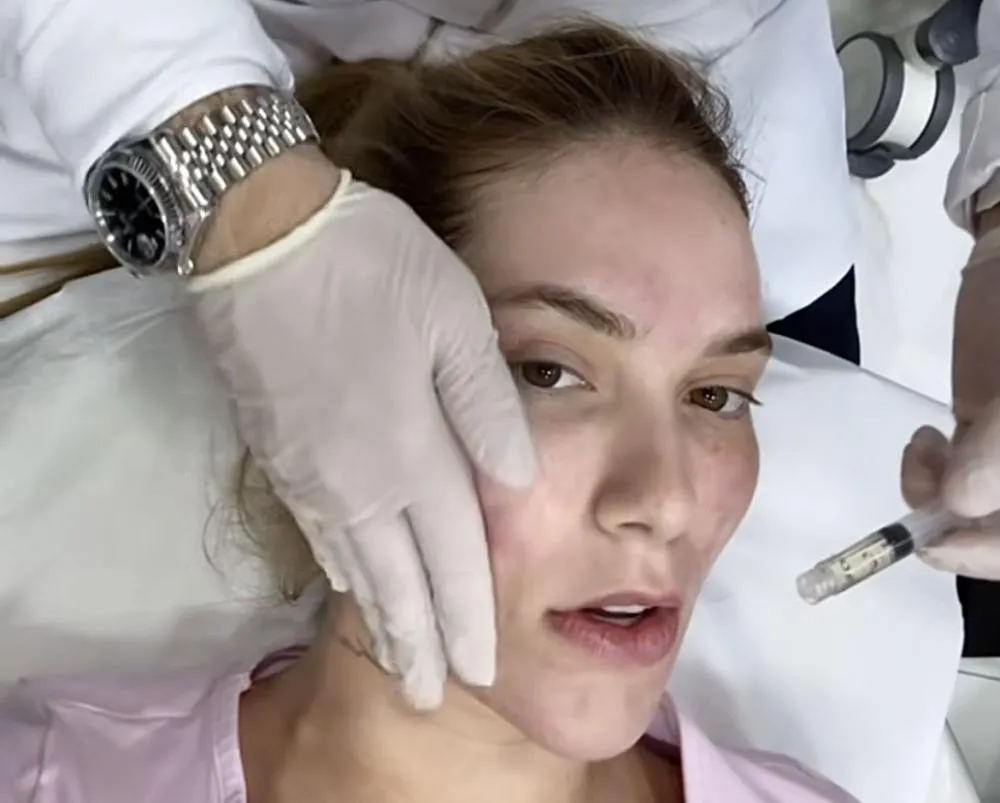  Virgínia Fonseca surpreende usando esperma de salmão para tratamento estético